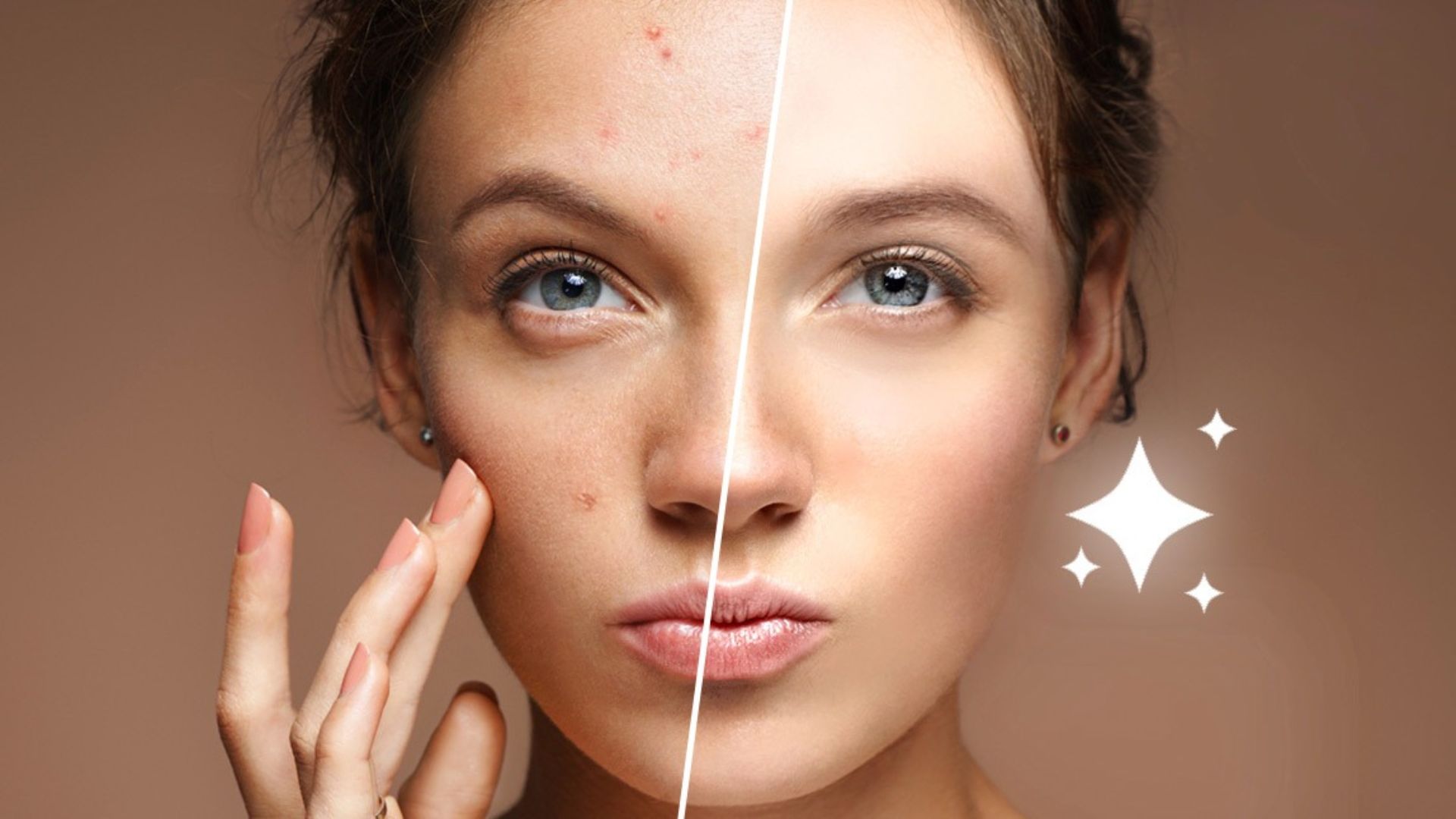 Meitu Photo Editor & AI Art (pimples)